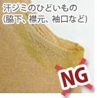 シミ